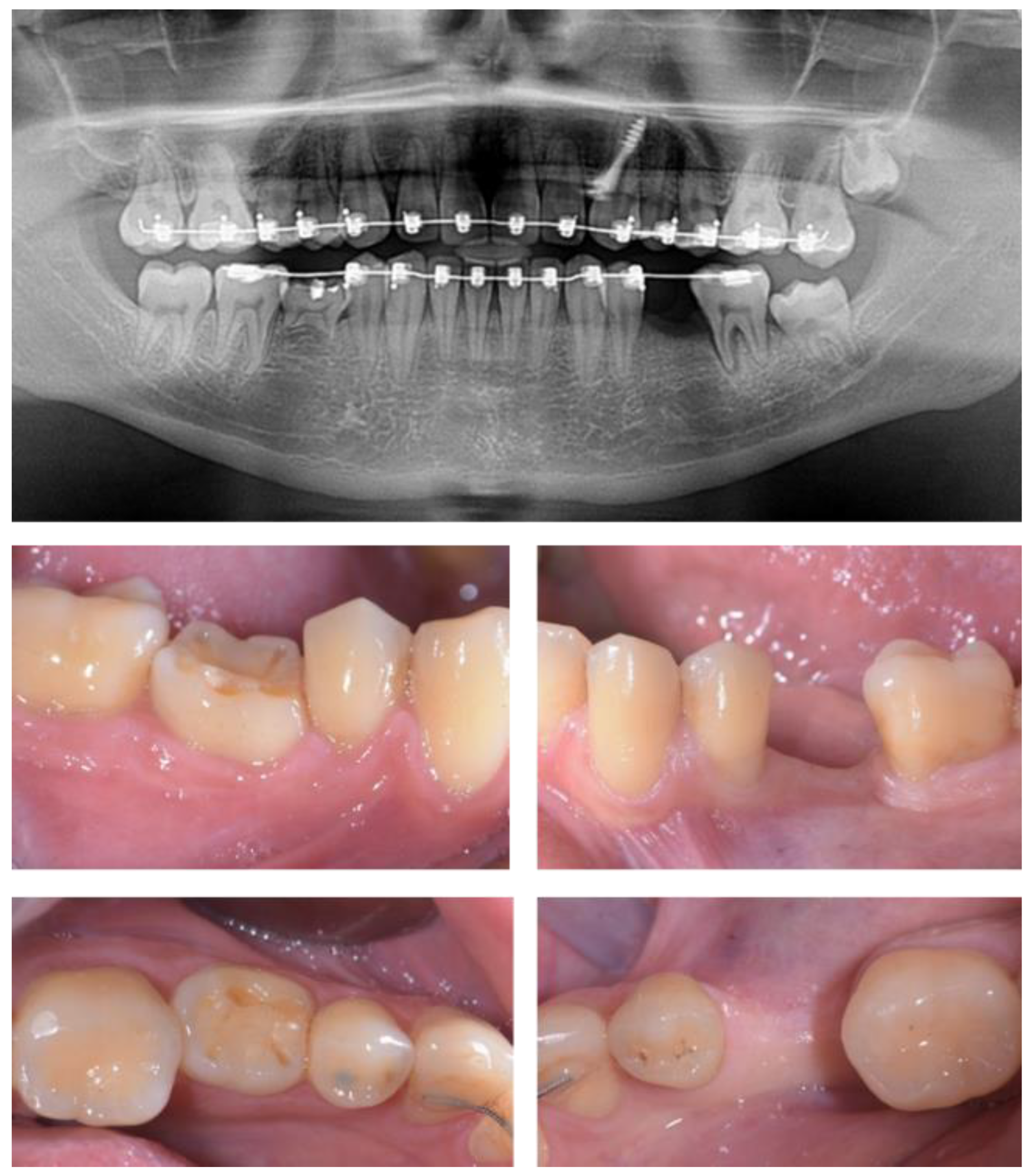 Pre-Surgical Preparation
