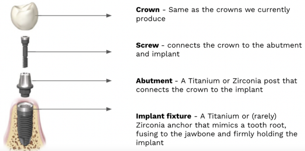All-on-4 Implants